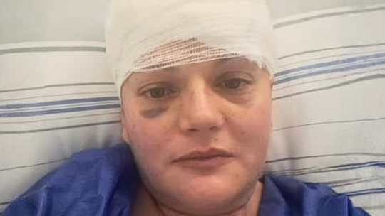 Ania, złośliwy nowotwór mózgu, Minoga, gmina Skała, na sygnale, pomagamy, zrzutka