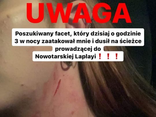 Na zdjęciu szyja młodej Nowotarżanki po ataku w Nowym Targu