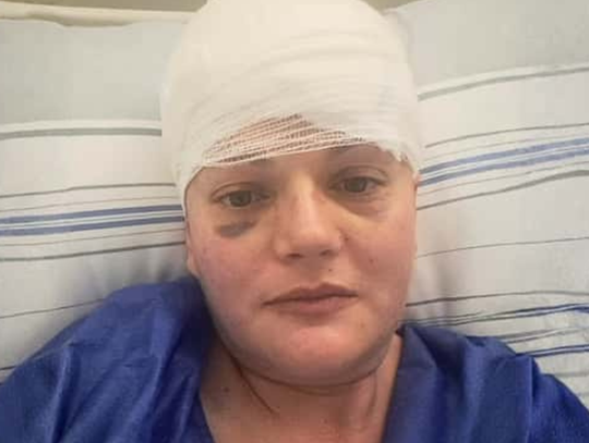 Ania, złośliwy nowotwór mózgu, Minoga, gmina Skała, na sygnale, pomagamy, zrzutka