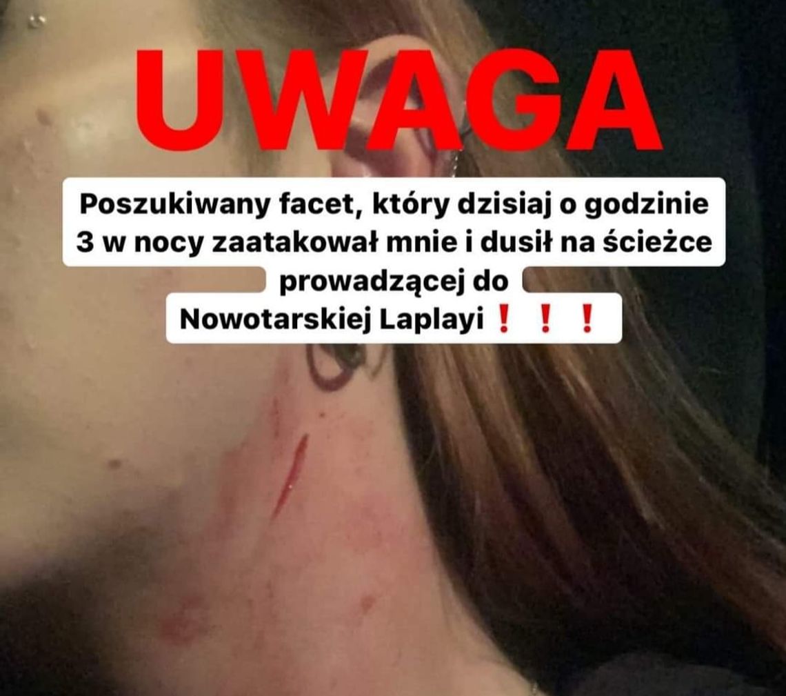 Na zdjęciu szyja młodej Nowotarżanki po ataku w Nowym Targu